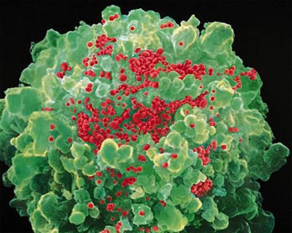 دراسة: فيروس الأيدز "يعود لملايين السنين"