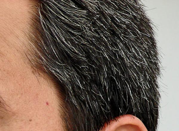 وصفات طبيعية لمنع شيب الشعر مبكرًا