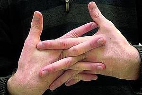 بالفيديو: هل تعلم ماهي مخاطر طقطقة الاصابع؟