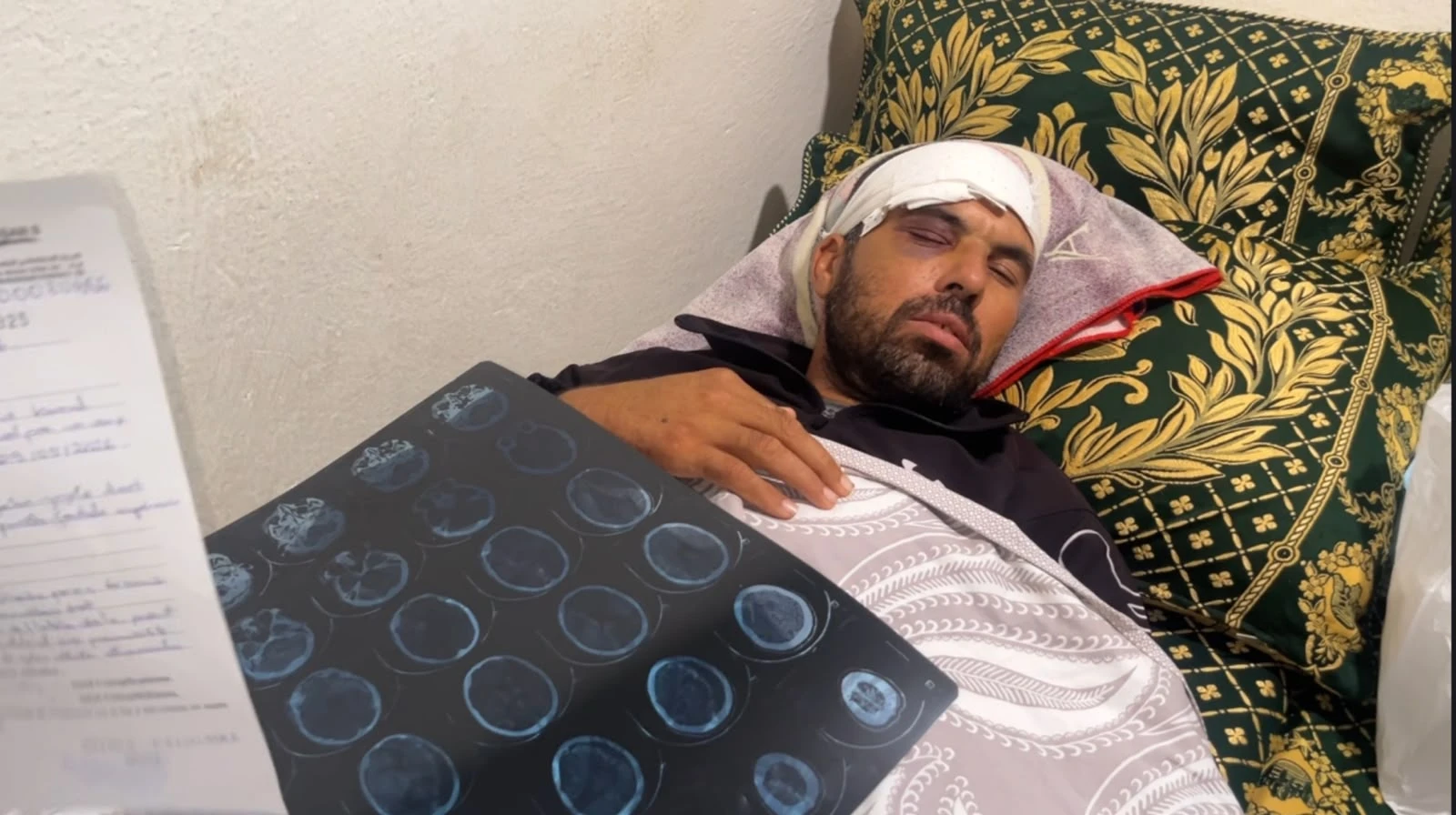 خطير.. فلاح من إقليم تاونات ينجو من الموت بعد تعرضه لهجوم من أقاربه