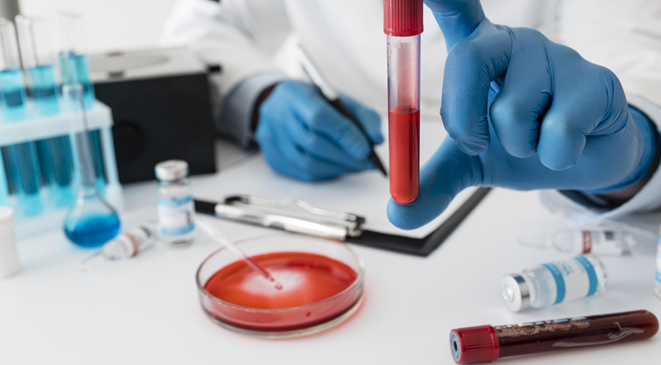 laboratory tests blood tests at home 1777329776