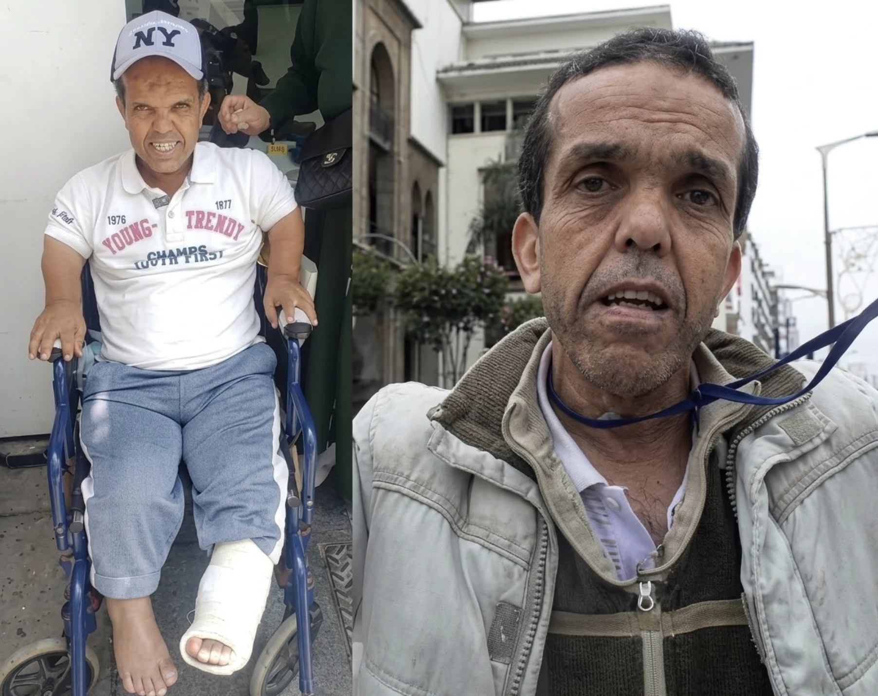 حادث سير قلب حياته رأسا على عقب.. ناصري يفتح ملف معاناة الجيلالي بوسكة عبر نداء تضامني