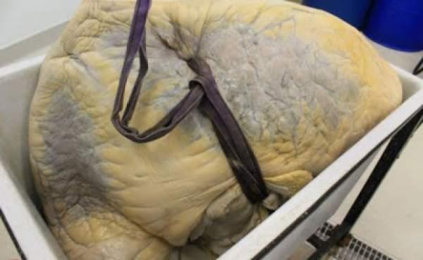 بالصور ....هل شاهدتم من قبل قلب الحوت ؟