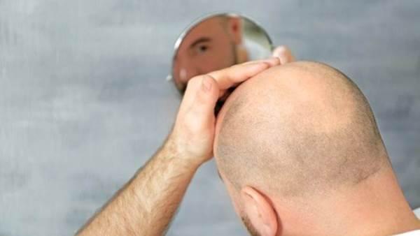 لماذا "كوفيد - 19" يقتل الرجال الصُلع غالبا؟