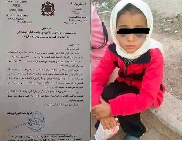 انتقادات فيسبوكية لبرلمانية بسبب سؤال تتهم فيه أستاذا بتعنيف تلميذة قبل انتهاء التحقيقات