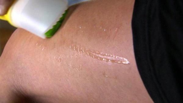 السيلوليت ليست مشكلة صحية فقط.. الوقاية والعلاج؟