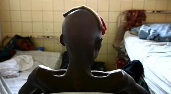 دراسة علمية: الإيدز ظهر في عشرينات القرن الماضي