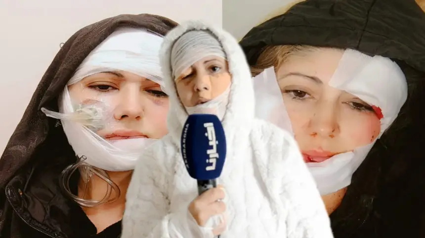 "ما رحمنيش".. سيدة تروي بحرقة تفاصيل اعتداء زوجها عليها بسلاح أبيض: "قطع ليا وجهي وكان غادي يقتلني"