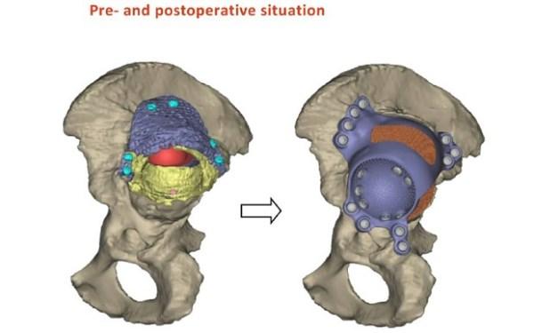 طباعة ورك اصطناعي ثلاثي الأبعاد