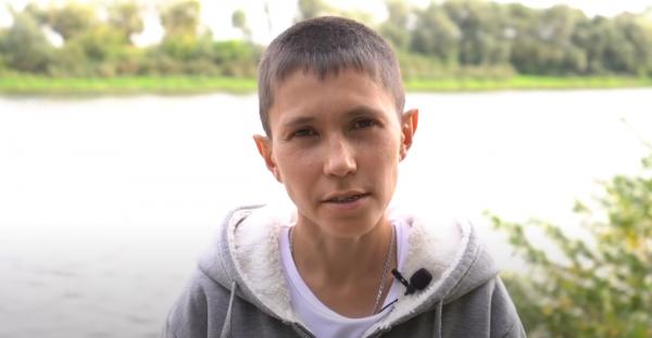 ثلاثيني في هيئة طفل بسبب حالة مرضية نادرة