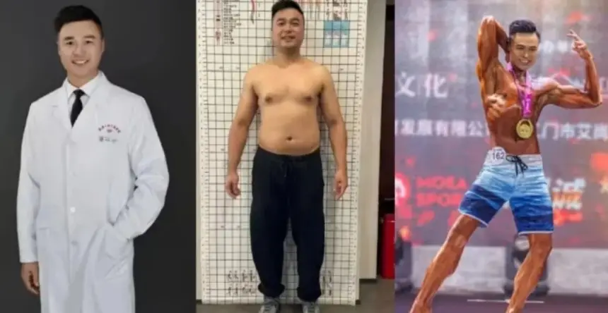 طبيب يفقد 25 كيلوغرامًا في 42 يومًا ويفوز ببطولة كمال الأجسام
