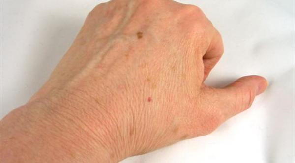 7 أشياء لا تعرفها عن الجلد والبشرة تهم صحتك