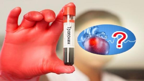 طريقة جديدة لتشخيص احتشاء عضلة القلب