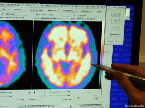 باحثون مغاربة يساهمون في اكتشاف مرض استقلابي جديد