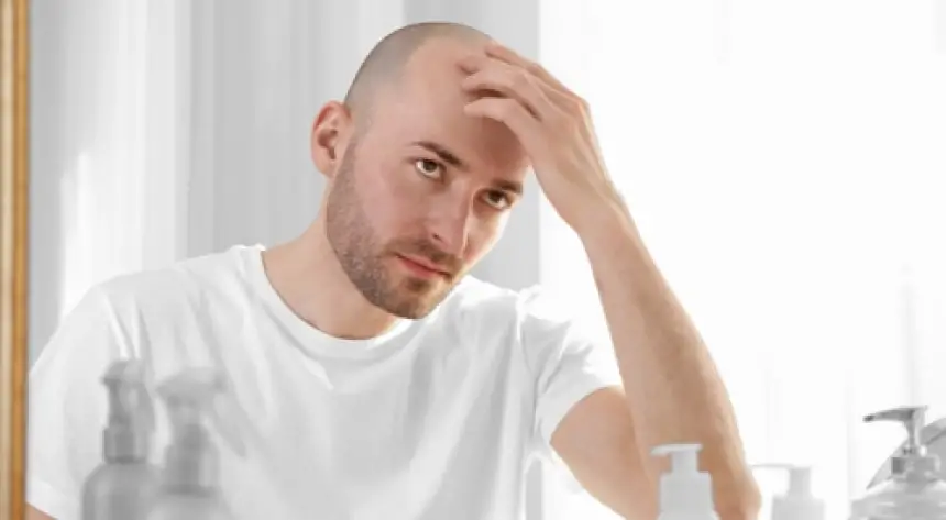 بشرى سارة للرجال: علاج موضعي جديد لمشكلة الصلع يعزز نمو الشعر حتى 500%
