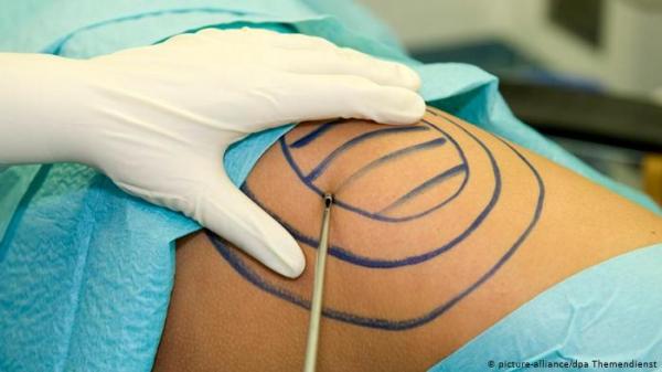 عملية تجميل تجر طبيبا للمحكمة بعد وفاة امرأة