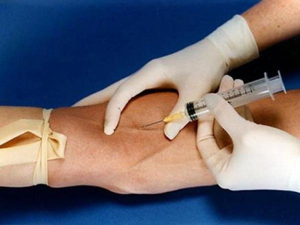 قريبا.. اكتشاف السرطان بنقطة دم واحدة