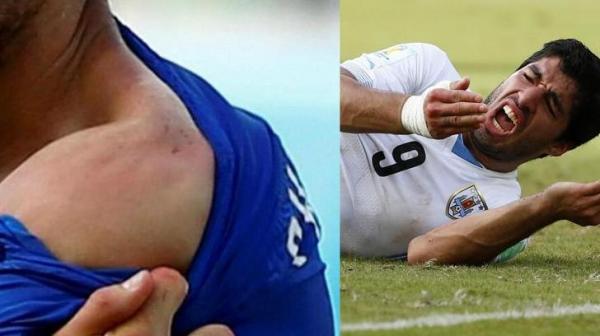 رئيس أوروغواي يعلن موقفه تجاه العضاض "سواريز"