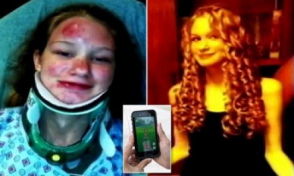 فتاة تتعرض لإصابة خطيرة بسبب لعبة البوكيمون