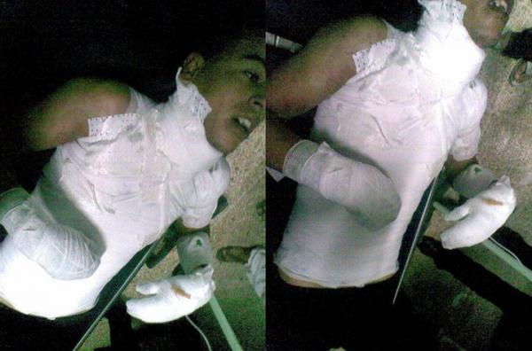 بركاني آخر يضرم النار في جسمه مساء الإثنين