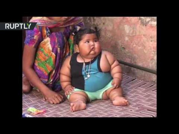 شاهات كومار.. رضيعة هندية عمرها 8 أشهر تزن 17 كيلوغراما