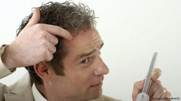 أشهر 10 خرافات عن تساقط الشعر