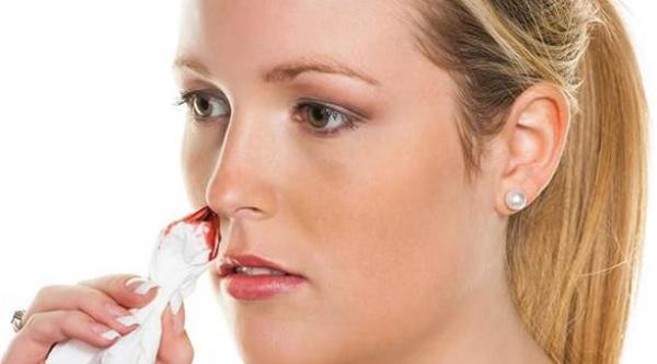 نزيف الأنف .. متى يستلزم استشارة الطبيب؟