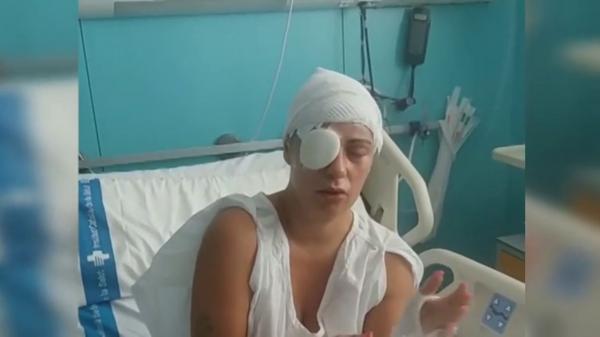 مهاجر مغربي يعتدي على إسبانية متزوجة وابنتها بمادة "الصودا الكاوية" والشرطة تحقق في ارتباطهما بعلاقة عاطفية (فيديو)