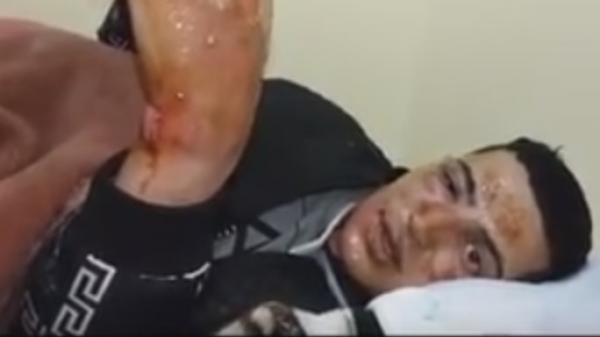 أحد الناجين من انفجار " عين عودة " يروي تفاصيل حادث الاثنين الاسود