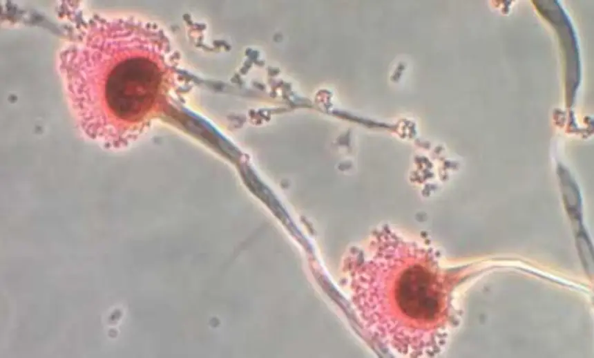 تحذير من انتشارها السريع.. فطريات قاتلة تأكل لحمك من الداخل