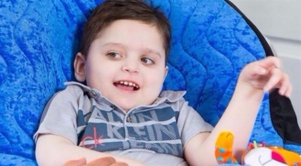 طفل يستعيد ابتسامته التي فقدها بسبب مرض نادر