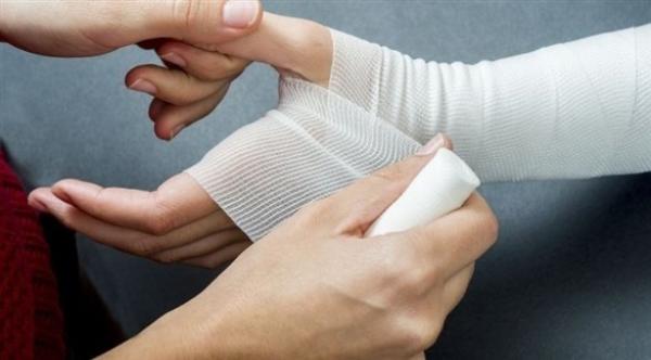 متى تستدعي إصابات اليد زيارة الطبيب؟