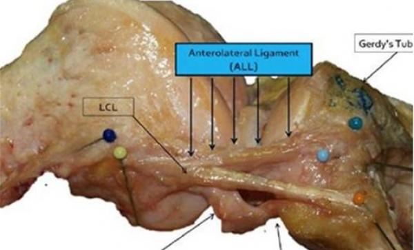 اكتشاف جزء جديد في جسم الإنسان يسبب إصابات الركبة