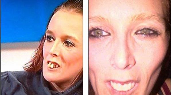 برنامج تلفزيوني يدفع 17 ألف دولار لإصلاح أسنان ضيفته