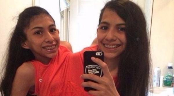 شقيقتان توأم ملتصقتان منذ الولادة ترفضان الانفصال