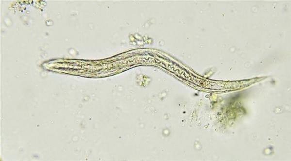 ما هي أسباب إصابة الأطفال بالديدان ؟