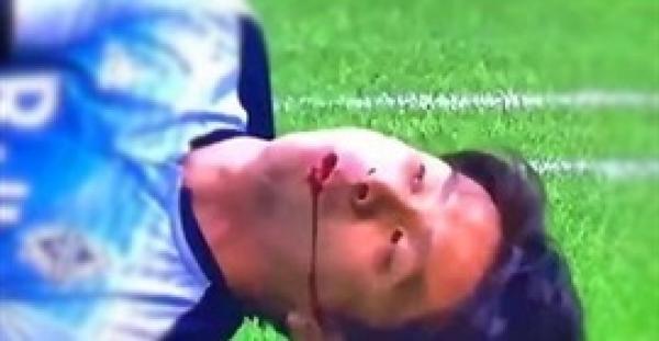 بالفيديو.. لحظة تعرض لاعب بالدوري الكندي لإصابة مميتة