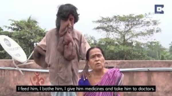 بالفيديو: "الرجل الفيل" يتحول أسطورة في الهند