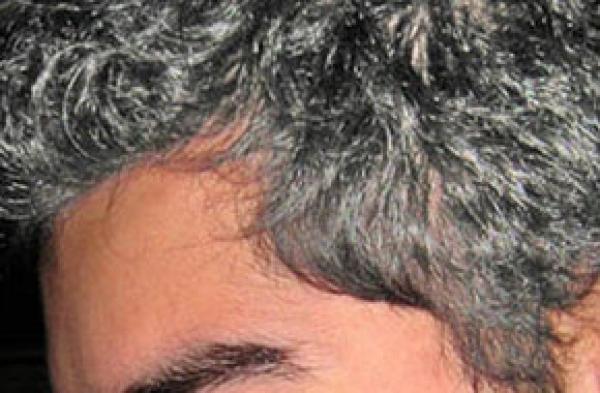 كيف يمكن الحد من انتشار الشيب المبكر؟