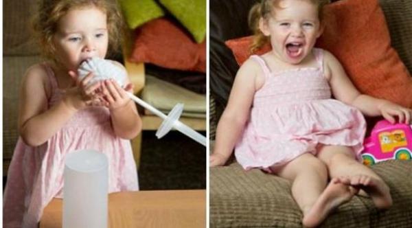 مرض يجعل طفلة مدمنة على التهام فراشي المرحاض