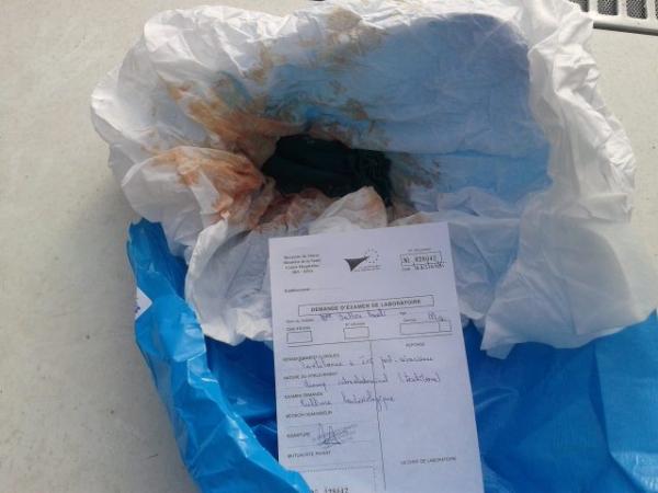 فضيحة.. نسيان قطعة قماش داخل بطن سيدة خلال عملية التوليد بمستشفى الخميسات