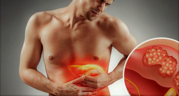 علماء يبتكرون أسلوبا لاكتشاف سرطان الكبد بناء على قطرة دم واحدة