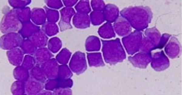 علماء أمريكيون: النجاح فى الزواج مرتبط بالجينات