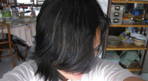 أسباب الشيب المبكر وطرق علاجه