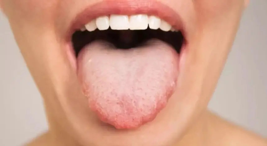 "لسان أوزمبيك": أثر جانبي جديد يغيّر طعم الطعام لمستخدمي أدوية إنقاص الوزن