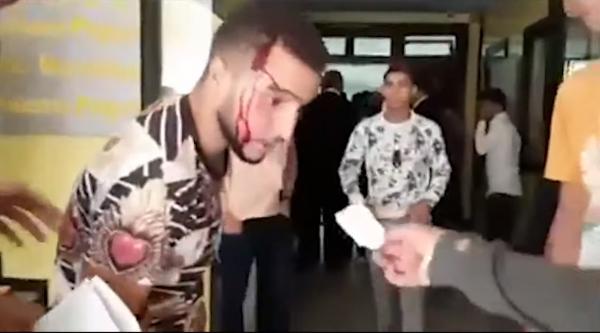 رمي للكراسي وتبادل للضرب والجرح في المجلس الوطني لشبيبة الحركة الشعبية بحضورالعنصر