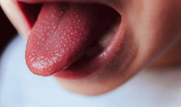 يستهدف الأطفال بالخصوص ...ظهور مرض "كوازاكي" الجديد بالجزائر