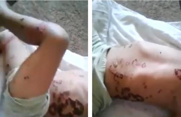 خطير .. شاهد ماذا حصل لطفل بعد تناوله ل"تشيبس"