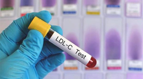 الكولسترول الضار يؤثر على الذاكرة والقدرة المعرفية