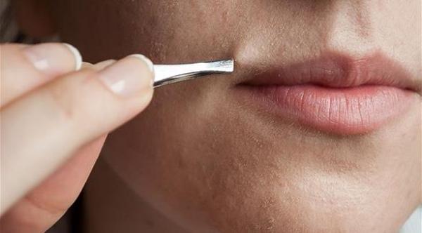 5 أسباب لنمو الشعر غير المرغوب فيه في وجه النساء